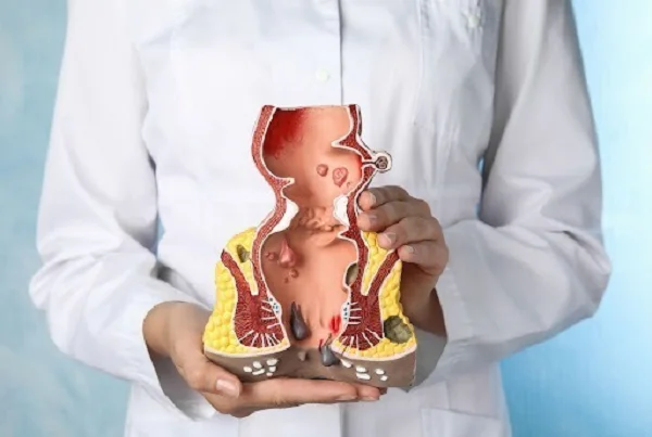 Chemical Sphincterotomy