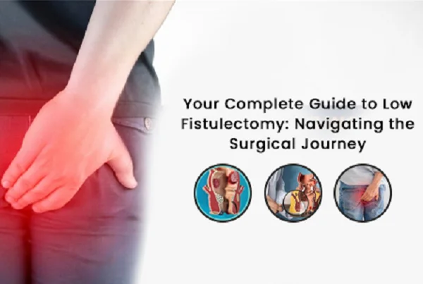 Fistulectomy